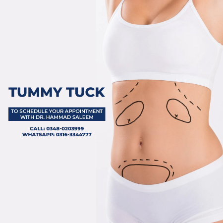 Tummy Tuck Surgery In Lahore